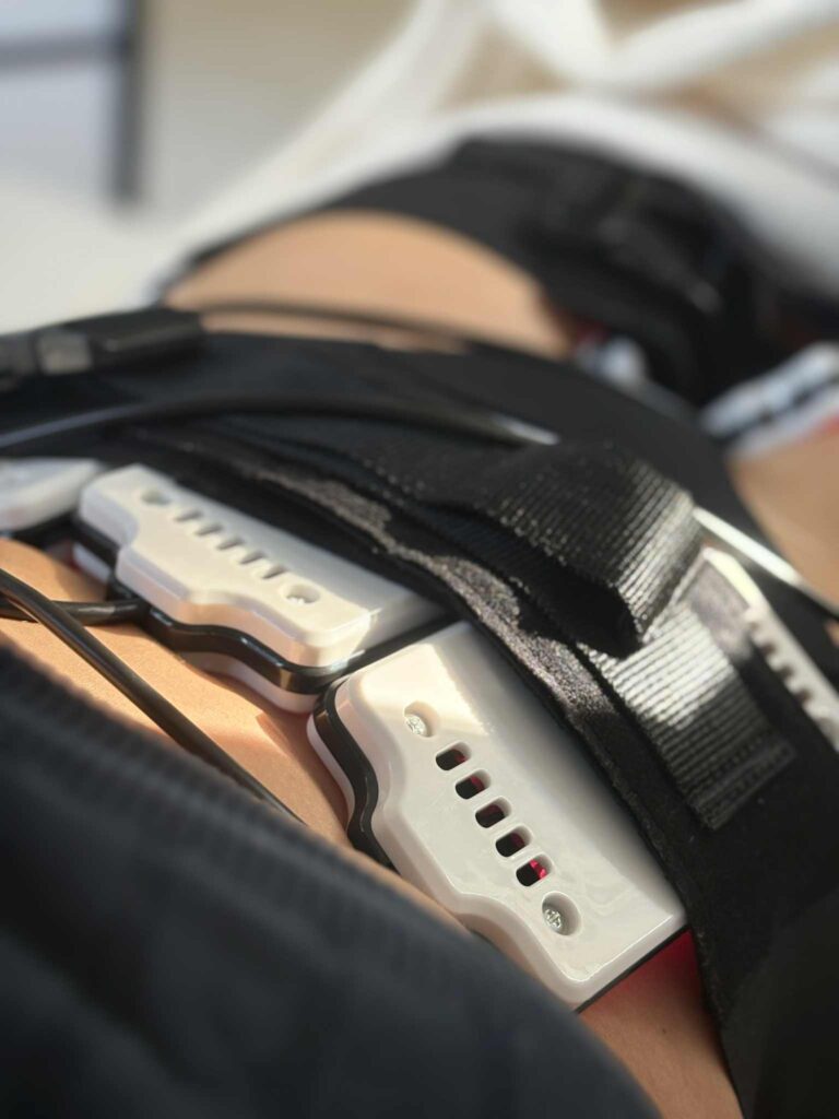 Kehahooldused 2026 - mis on trendid? lipolaser kiilis